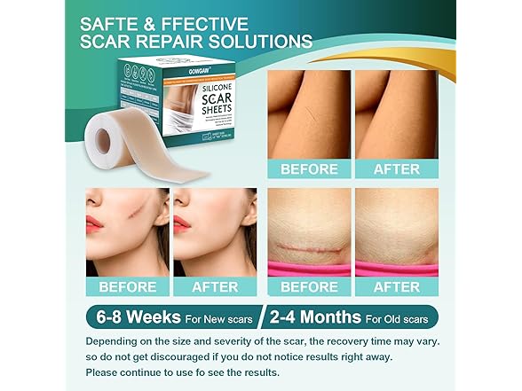 Gowgaw Medical Grade Silicone Scar Sheets