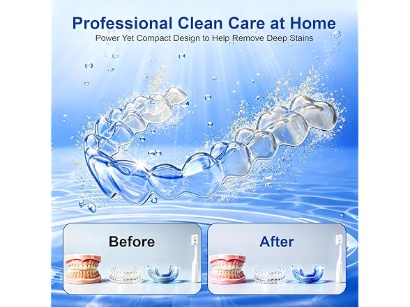 Newelkin Ultrasonic Retainer Cleaner Black