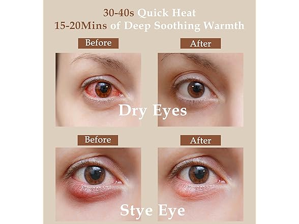 TOPOINT BC513225100022 Microwave Heated Eye Mask