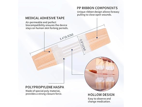 Emergency Wound Closure Device