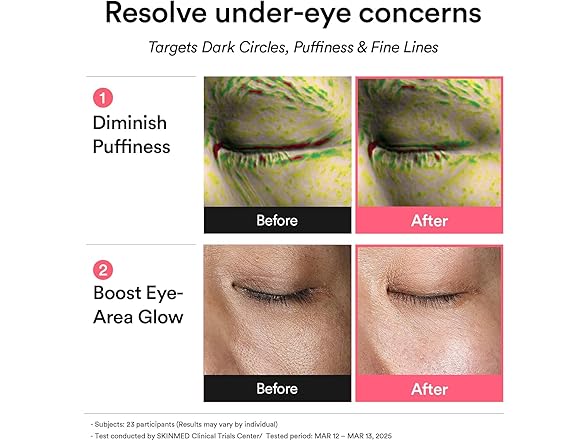 Abib PDRN Retinal Eye Patches 60ct