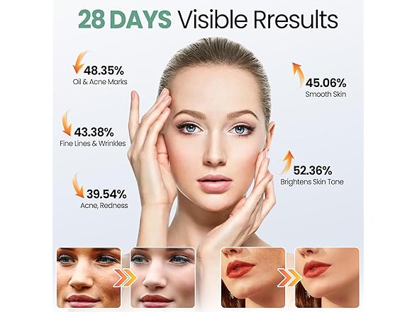 Oiameen Red Light Mask, 7-clolor Red Light Therapy Mask