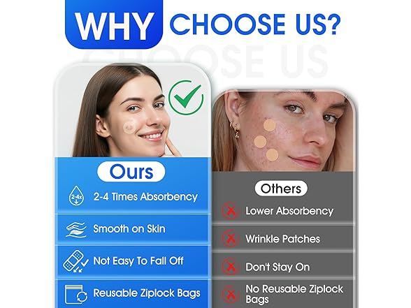 AKQFZHQ Hydrocolloid Roll for Wound Care