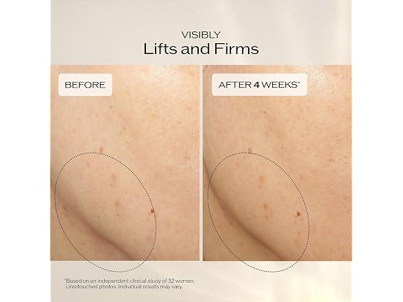 Shiseido Shiseido Vital Perfection Uplifting And Firmi