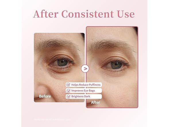Xenjura Retinol & Caffeine Eye Roller