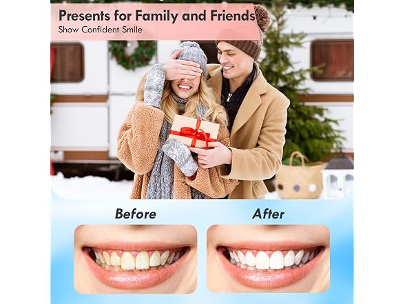 Rechargeable Teeth Polisher 5 Speed