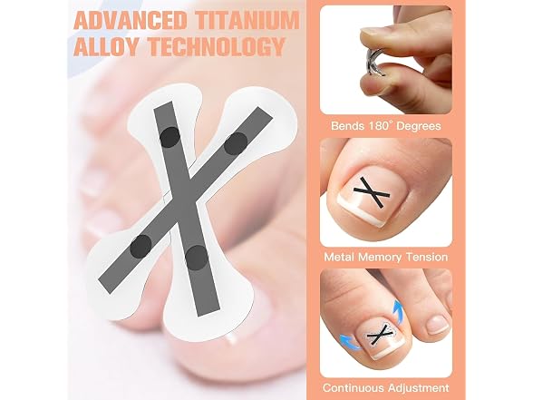 Ingrown Toenail Treatment Kit