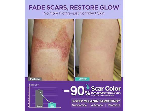 EASEWAVE Dual Action Repair Scar Cream