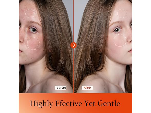 KGDYQZQ 20% Vitamin C Serum