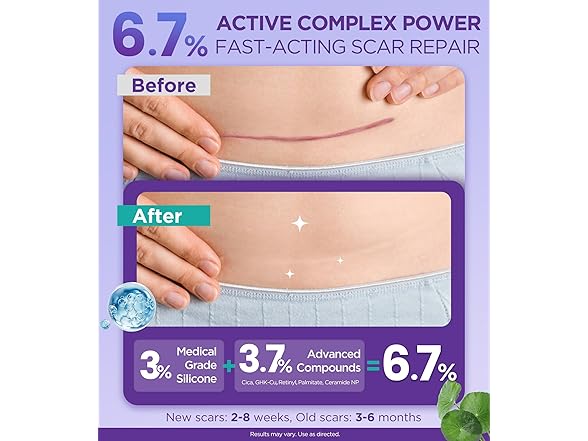 EASEWAVE Dual Action Repair Scar Cream