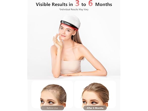 Laser Hair Growth Cap