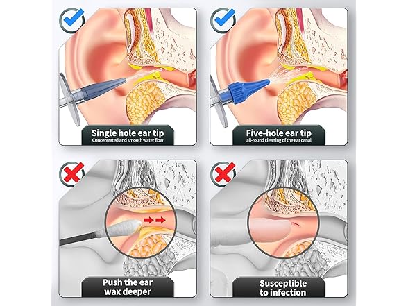 WEUANY Ear Wax Removal Kit