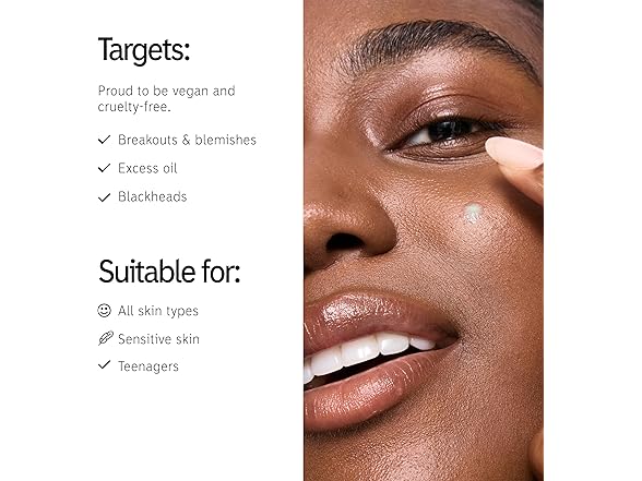 The INKEY List Succinic Acid Treatment