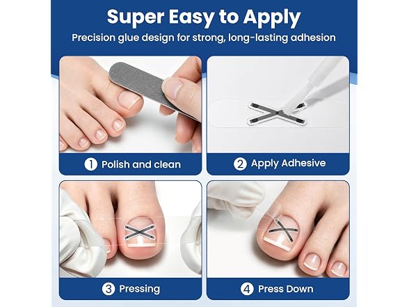 CosFancy Ingrown Toenail Treatment Kit