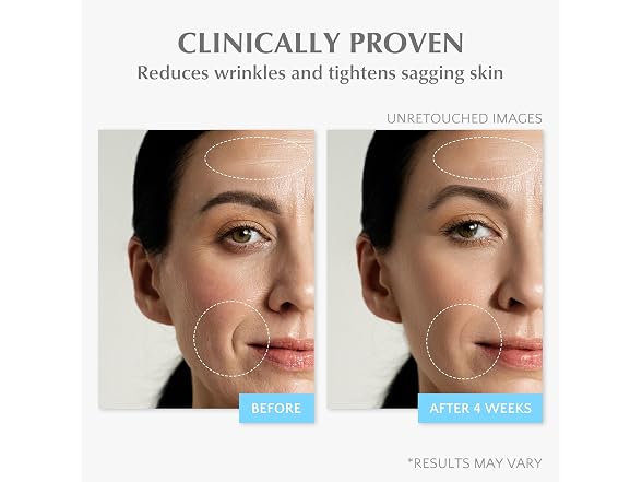 Retinol Collagen Face Cream: Wrinkle