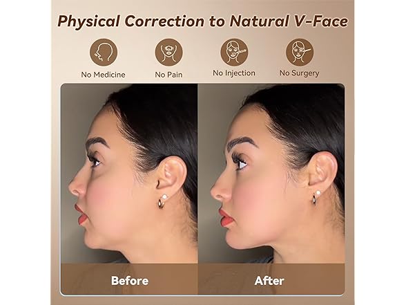 JUSRON BC135325100059 Face Strap