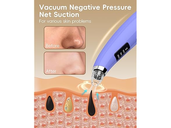 Facial Pore Blackhead Remover Vacuum