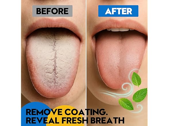 COSMOPLUS Stainless Tongue Scraper Set for Adults - Gallery 4