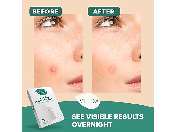 Veeda Glow Pimple Patches
