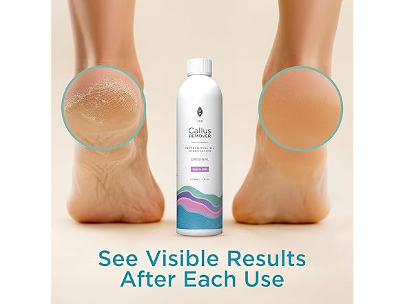 Lee Beauty 8oz ProfessionalGel Callus R