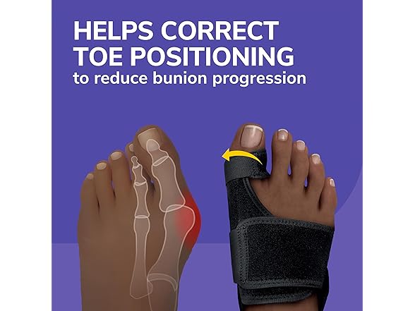 Dr Scholls Bunion Relief Toe Corrector 1 Set