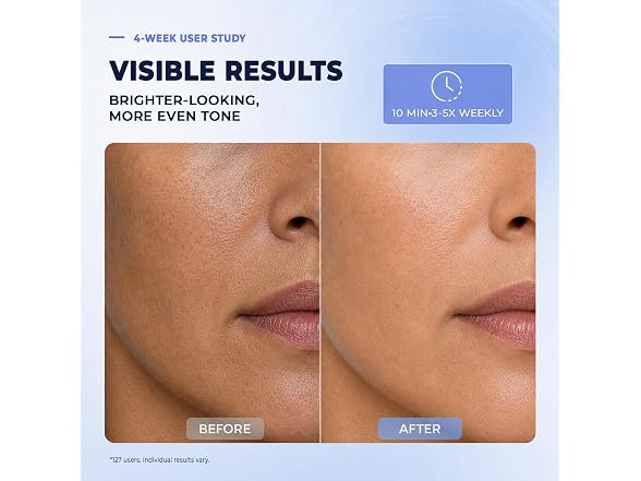 Red Light Therapy Mask - Blue