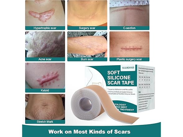 SLUKHIG Silicone Scar Tape For Scar Treatment