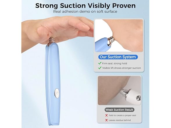 Tonsil Stone Remover Kit