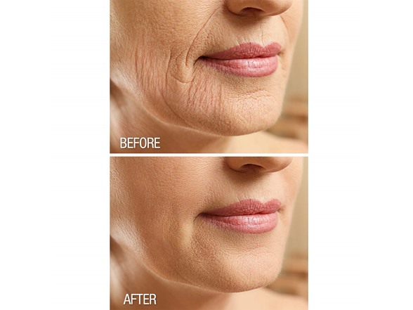 Facial Anti Aging Skin Cream