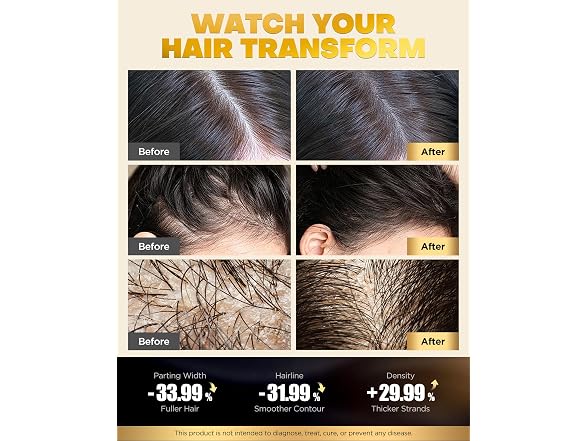 COOLKESI Tripeptide-Infused Biotin Hair