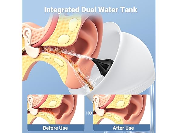 ScopeAround Earwax Removal Ear Cleaner