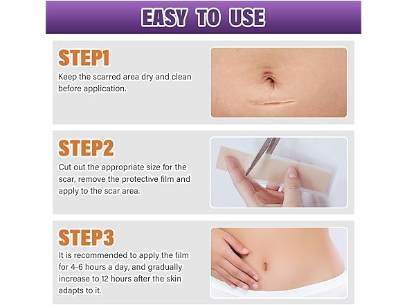 Silicone Scar Sheets (1.6"X59" Roll-1.5M)