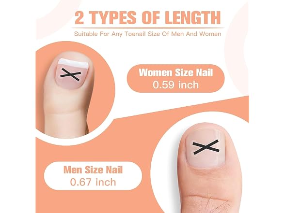 Ingrown Toenail Treatment Kit