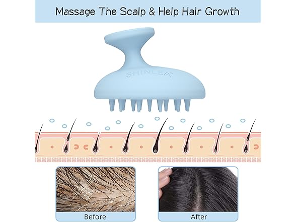 SHINLEA Silicone Scalp Massager Brush, Blue