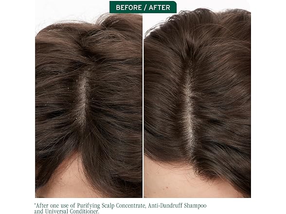 Biolage Matrix Biolage Scalp Sync Purifying Scalp Con