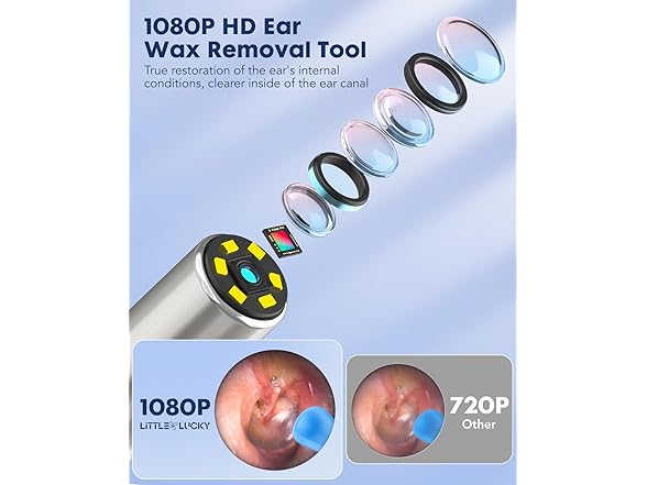 Littlelucky Ear Wax Removal Camera