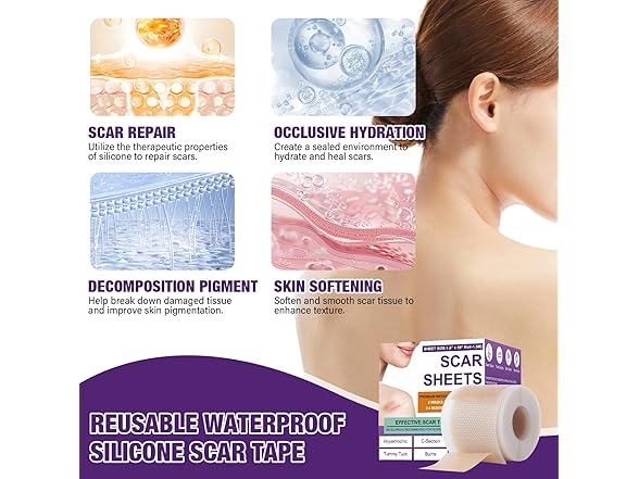 Silicone Scar Sheets (1.6"X59" Roll-1.5M)