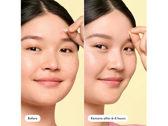 Mighty Patch Mini Invisible+ Patches