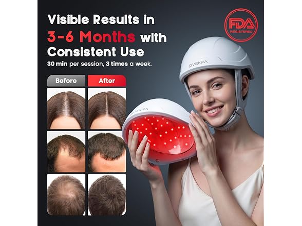 OVEKPA Laser Cap for Hair Regrowth