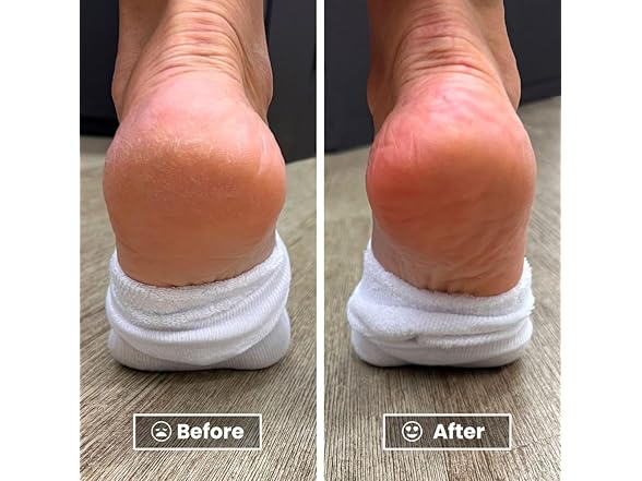 LONDONTOWN Pedikur Foot Balm