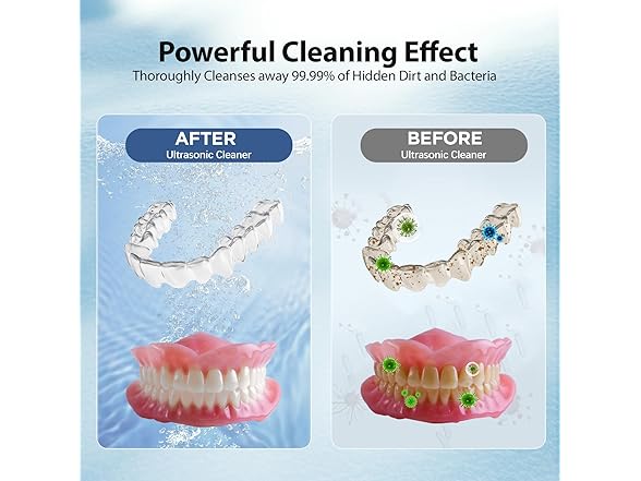 Hiwill Retainer Cleaning Machine:43000Hz