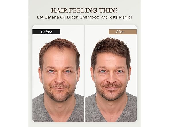 Biotin Shampoo for Hair Growth