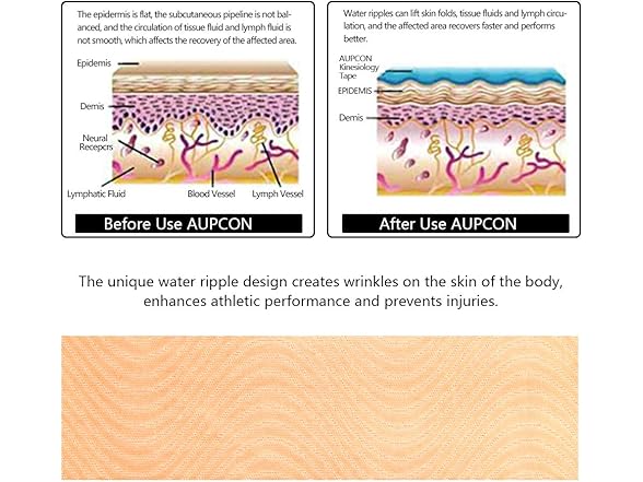 AUPCON Kinesiology Elastic Tape