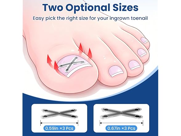 CosFancy Ingrown Toenail Treatment Kit