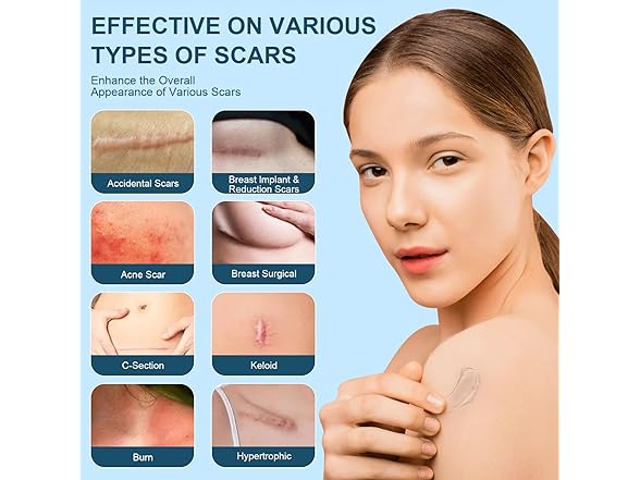 Mitgary Scar Gel Scar Cream