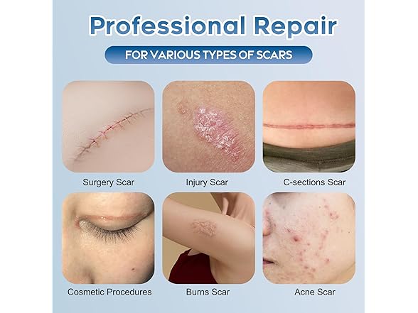 Glowor Advanced Silicone Scar Gel
