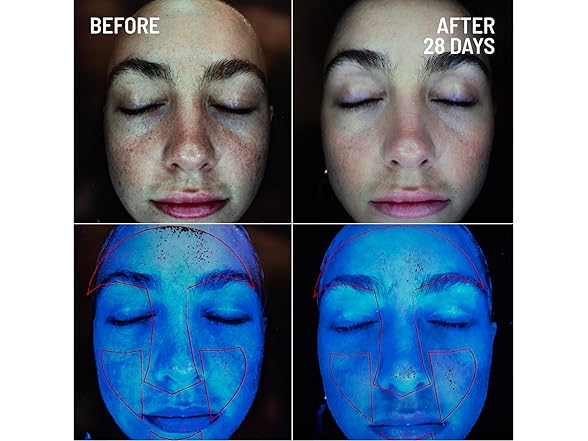 Dr. Brandt Renewing Face Exfoliator