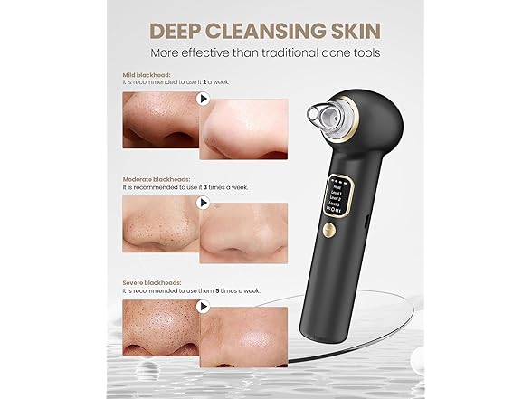 YAGETU Blackhead Remover Vacuum