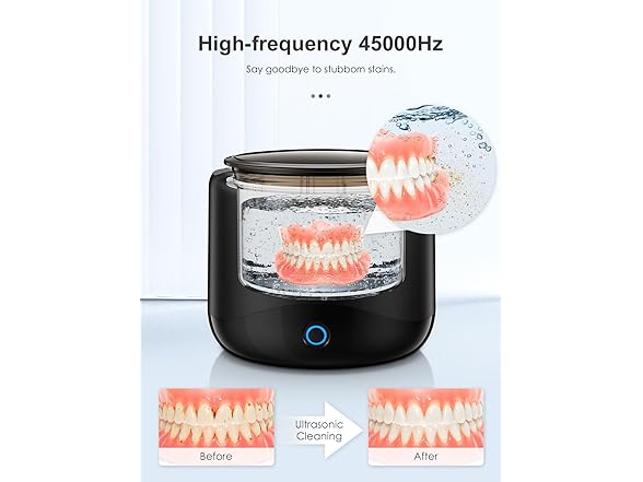 RELEXNOW 45kHz Retainer Cleaner Machine for Dentu