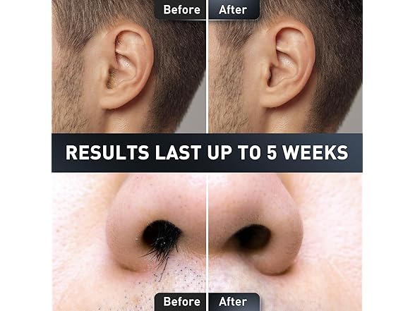 Azang Wax Kit for Hair Removal